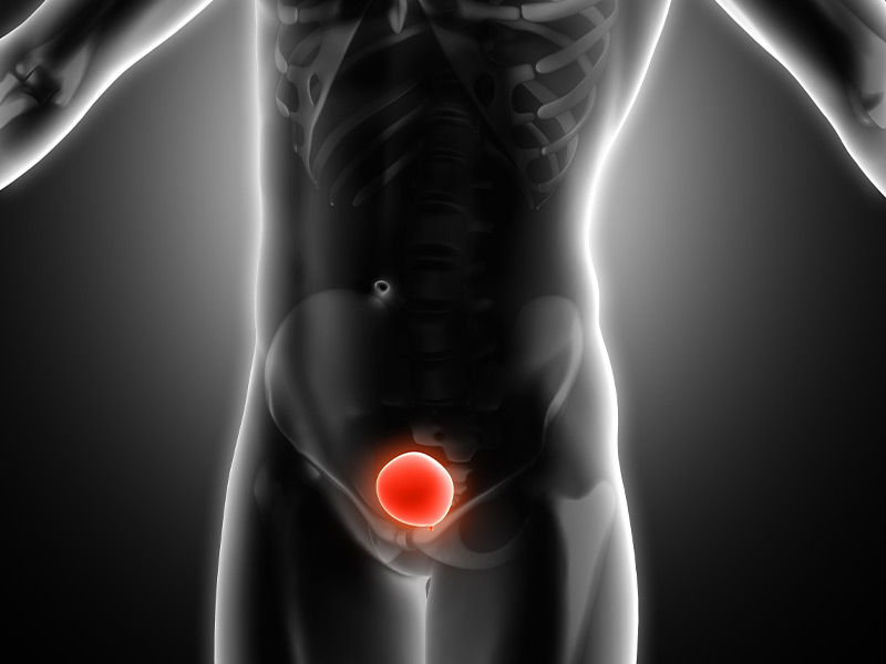 Micção difícil ou lenta? Entenda quando procurar o urologista