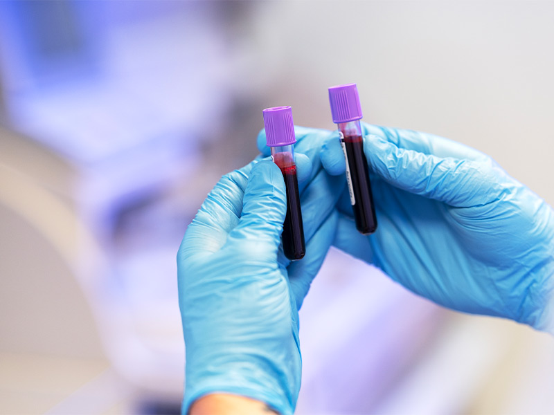 5 Mitos e verdades sobre o PSA