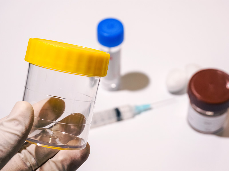 Sangue na urina? Saiba o que pode ser e quando consultar um urologista