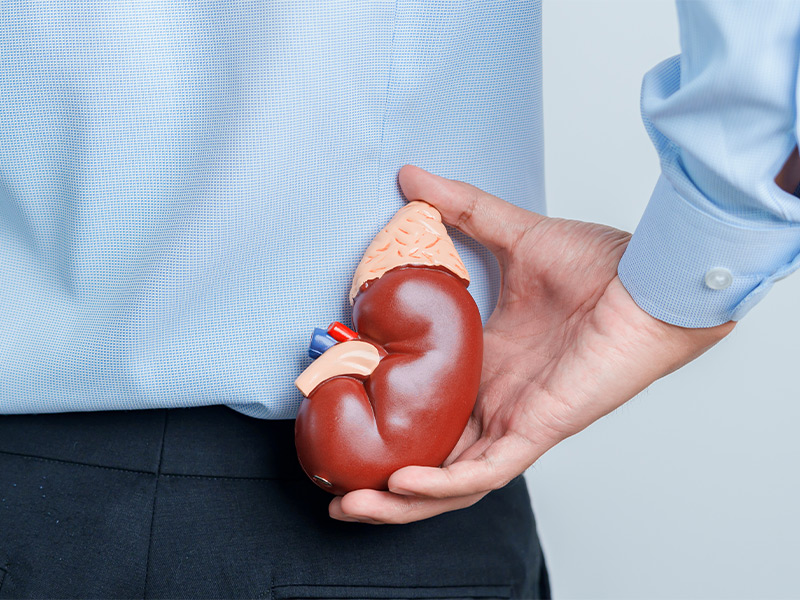 Como a dor lombar pode ser um sinal de cálculo renal: o que observar e quando ver um urologista