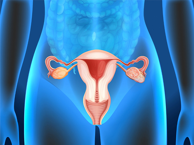 Imagem ilustrativa Incontinência Urinária Feminina   - Dr. Gino Pigatto Filho Urologista